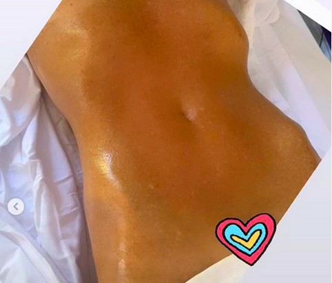 A modelo Elle Macpherson após seu tratamento para secar a barriga (Foto: Instagram)