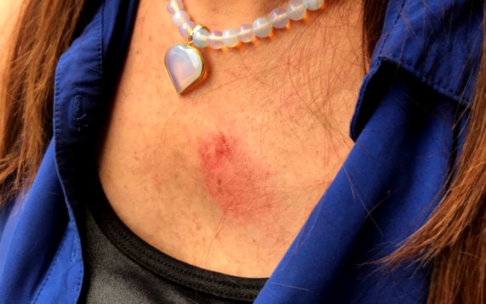 Aluno arremessa cadeira e deixa professora ferida em escola do DF (Foto: Arquivo pessoal)