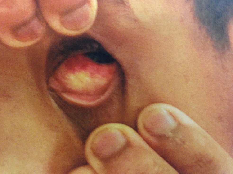 Adolescente interno da Fundação Casa com marcas de agressão — Foto: Defensoria Pública