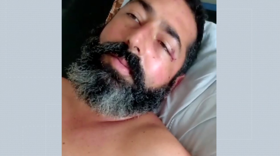Homem quebra as duas pernas após ser atropelado e prensado entre carro e caminhonete em Ituverava (SP) — Foto: EPTV/Reprodução
