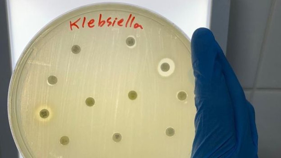 Klebsiella pneumoniae faz parte de categoria 'crítica' das bactérias contra as quais o desenvolvimento de novos remédios é mais urgente, segundo lista da OMS — Foto: Divulgação