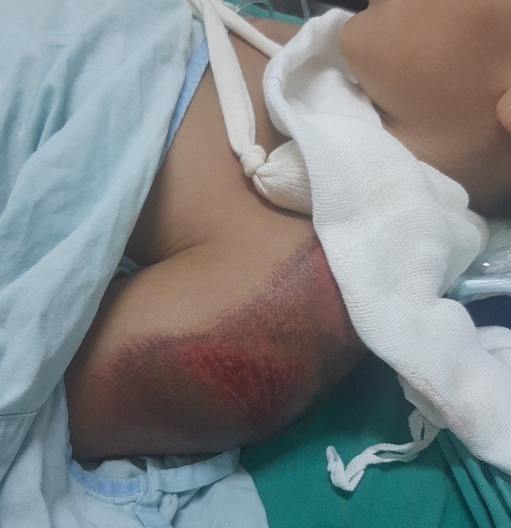 Menino de 11 anos é atropelado enquanto brincava de pipa em Vilhena, RO