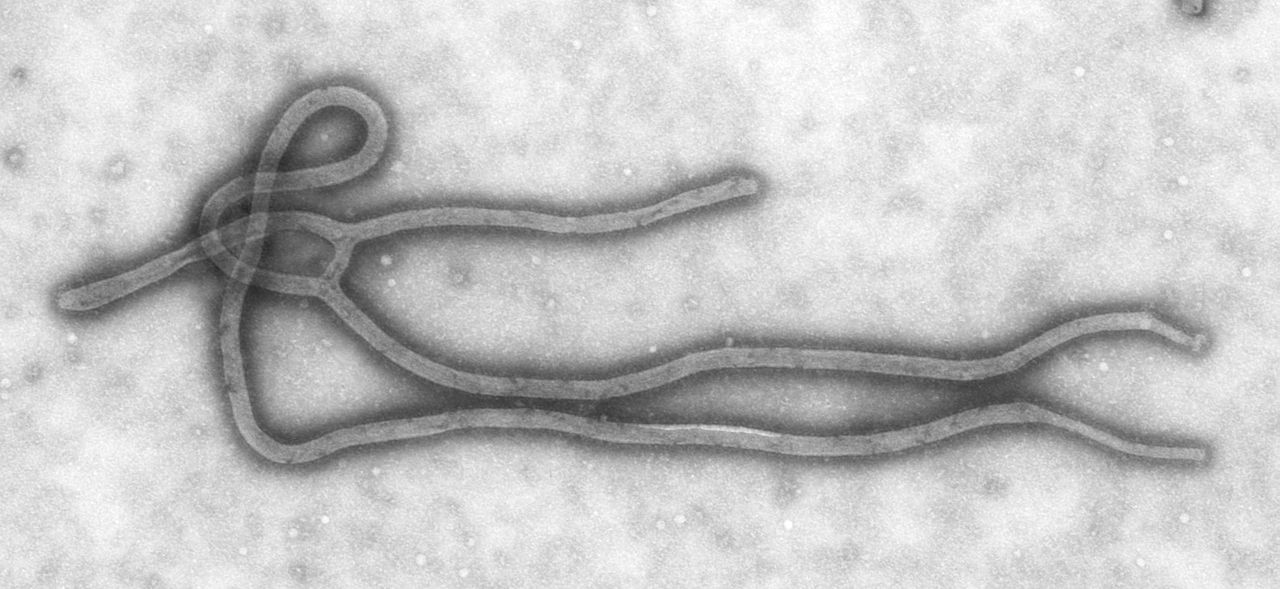 Um 'close' na partícula viral do Ebola (Foto: Wikimedia Commons)