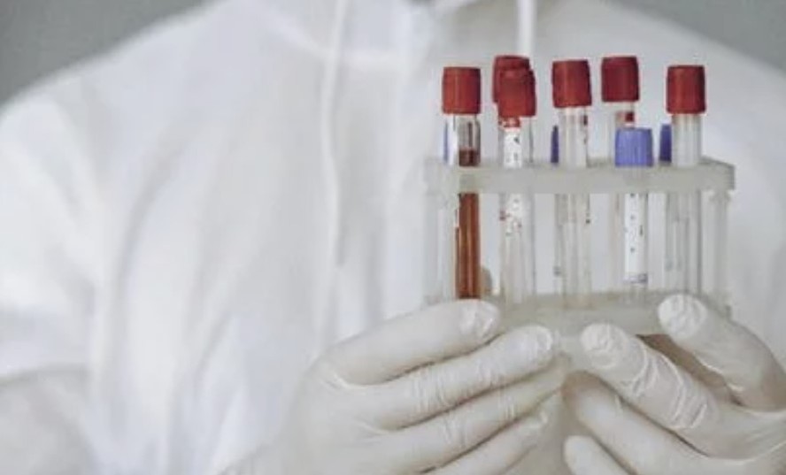 Tecnologia detecta câncer em estágios iniciais por meio de um exame de sangue