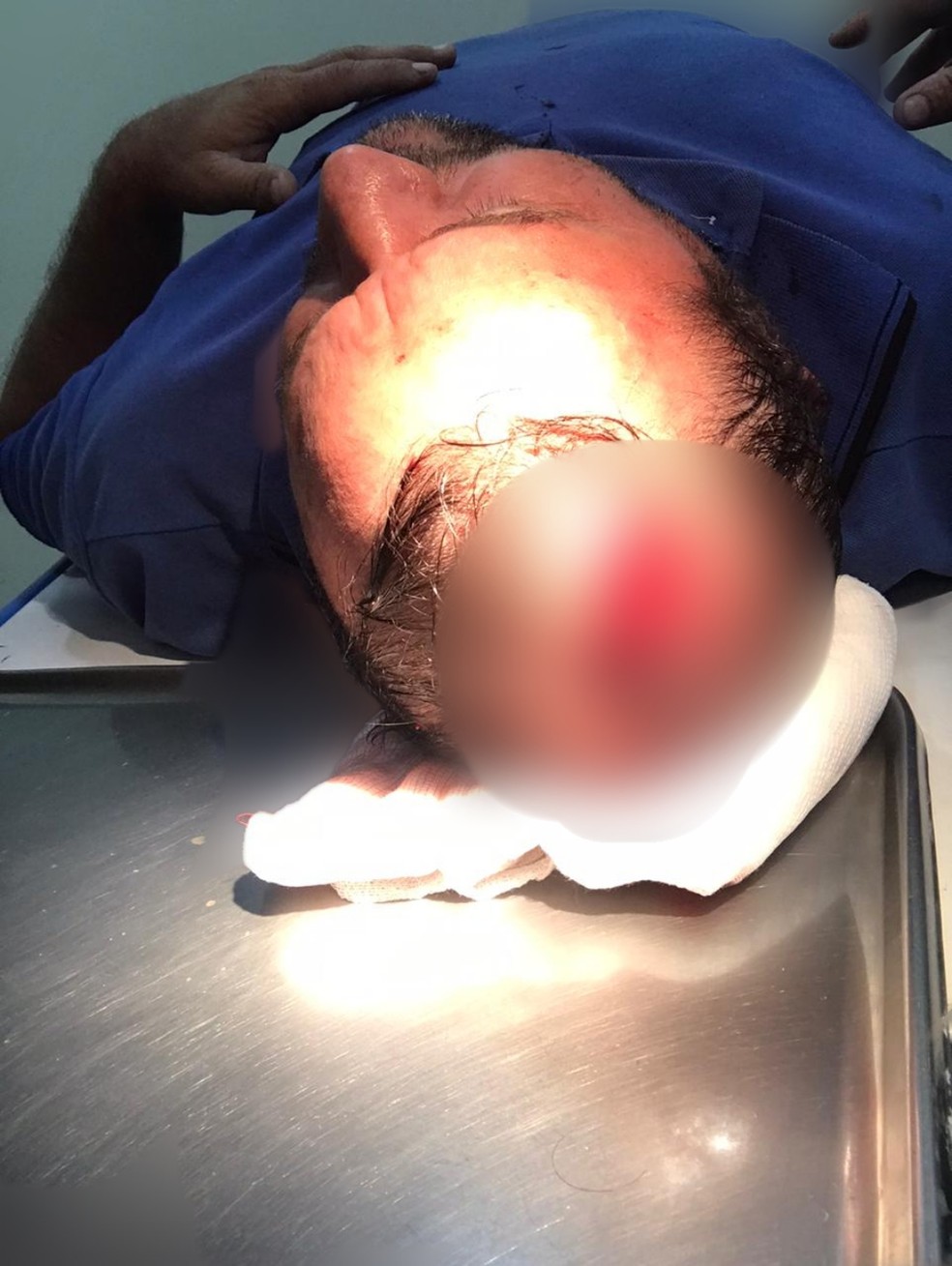 Amair Feijoli foi agredido a paulada por agricultor que briga por terra no interior de Sena Madureira — Foto: Reprodução