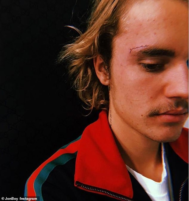 Justin Bieber com a palavra 'Grace' tatuada em cima da sobrancelha (Foto: Instagram/Reprodução)