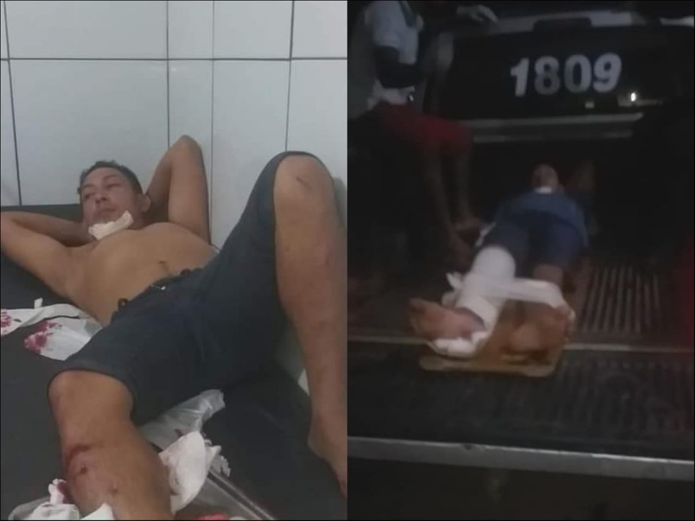 Maxdiego quebrou a perna direita, foi levado em uma viatura ao hospital; ele fez cirurgia em Santarém  — Foto: Reprodução/Facebook 