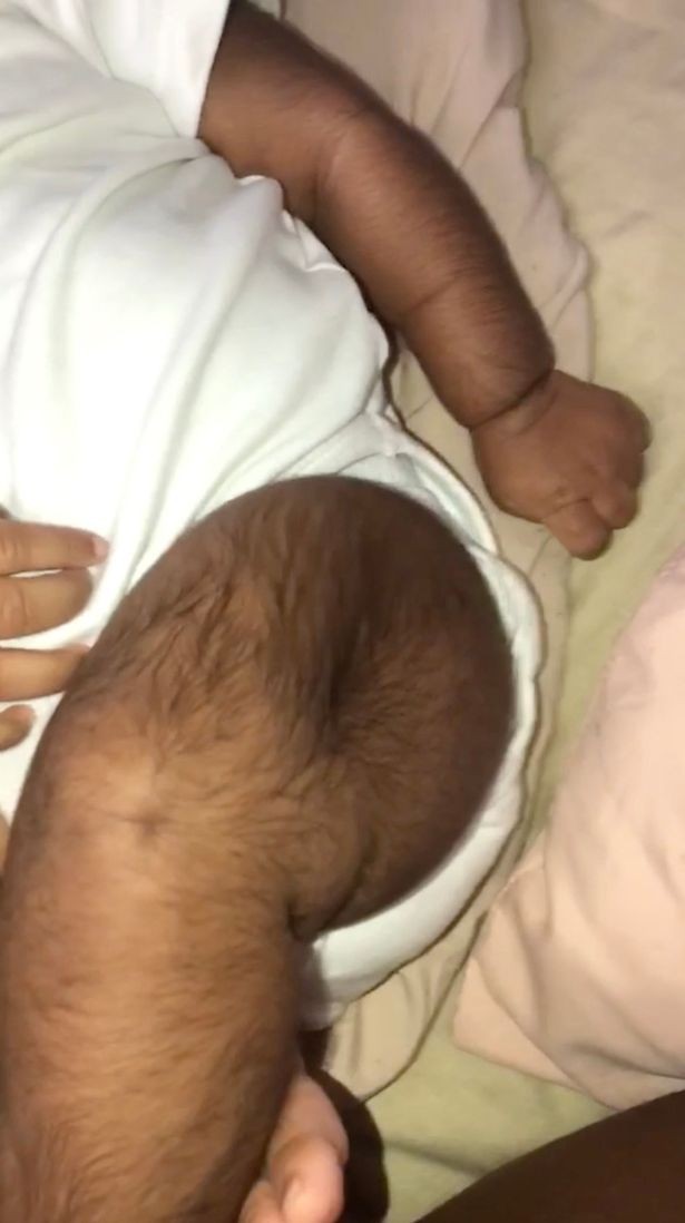 Bebê nasce com excesso de pelos no Texas (Foto: The Mirror)