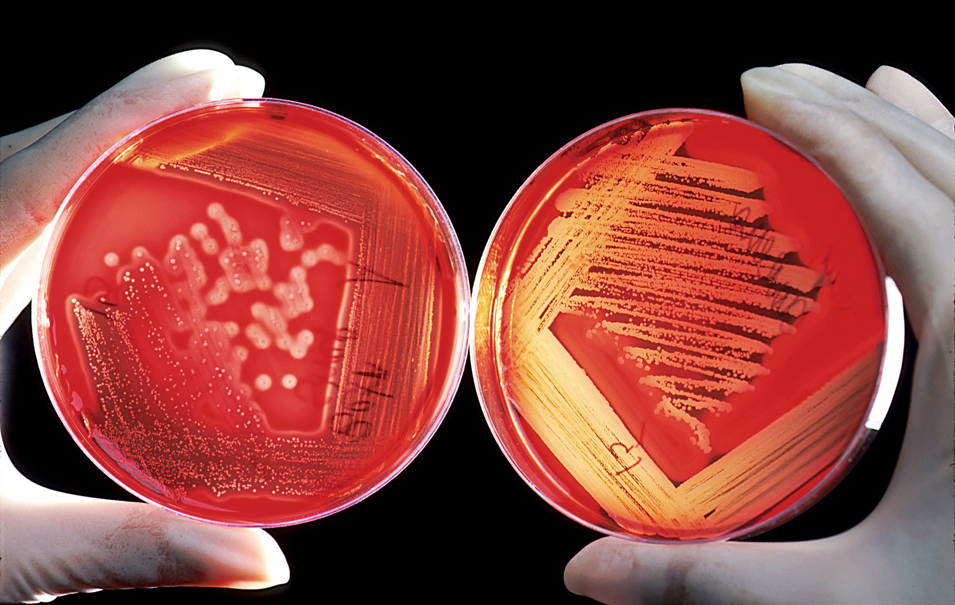 Colônia de bacterias (Foto: Wikimedia Commons)