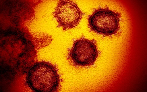 Os picos na superfície do novo coronavírus são comuns entre cepas da mesma família de vírus, como SARS-CoV e MERS-CoV. Foto: NIAID-RML