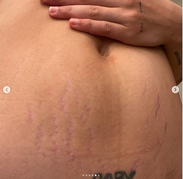 A foto da barriga da cantora Halsey três semanas após o nascimento de seu primeiro filho (Foto: Instagram)