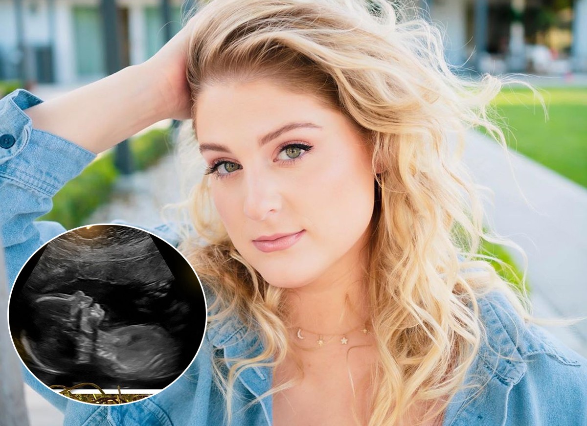 Meghan Trainor anuncia primeira gravidez (Foto: Reprodução / Instagram)