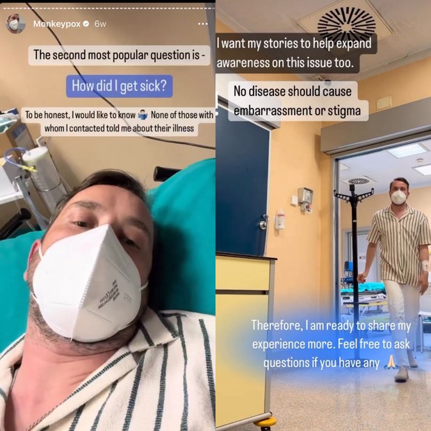 Maxim Sapozhnikov compartilhou sua luta com a Monkeypox em suas redes sociais (Foto: Reprodução/ Instagram)