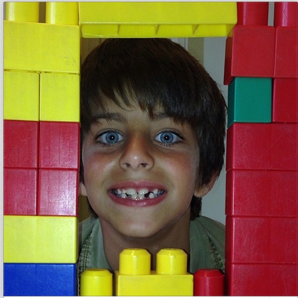 Lucas mostra as janelinhas nos dentes (Foto: Reprodução/Instagram)