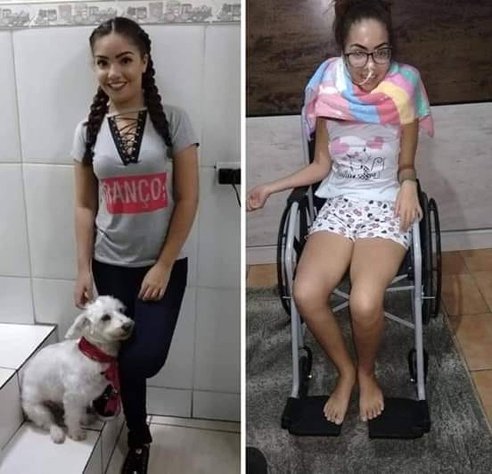 Marcely Oliveira descobriu ser portadora da doença de Wilson com 17 anos — Foto: Arquivo Pessoal