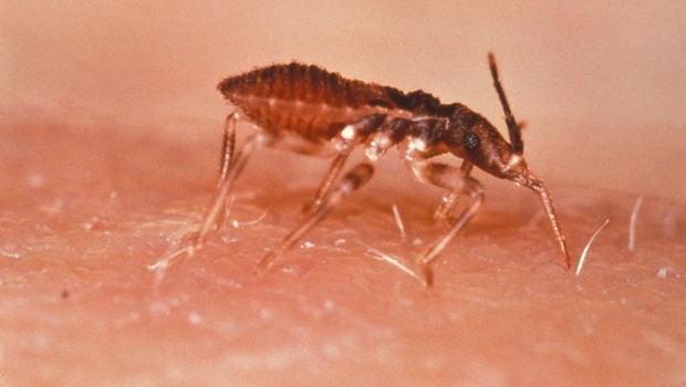 Doença de Chagas (Foto: Wikimedia Commons)