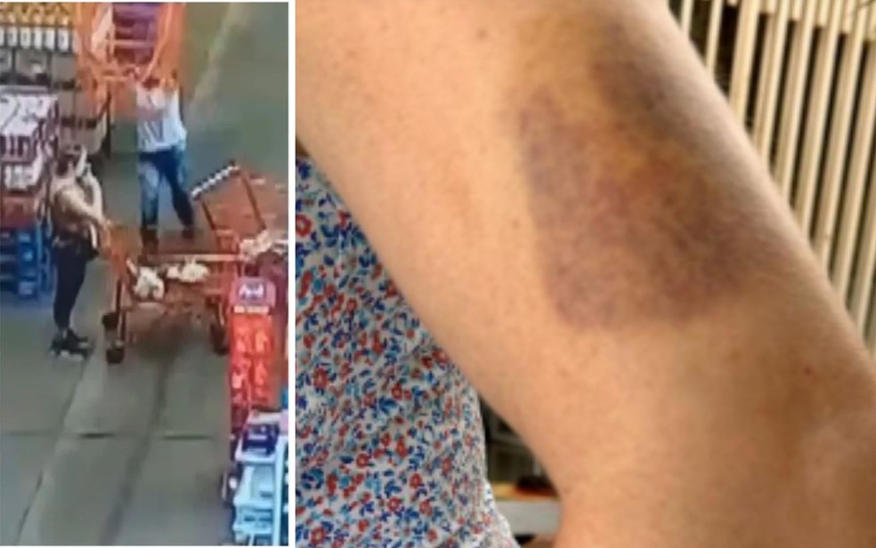 Cliente golpeada com carrinho de compras diz que ainda sente dores e tem medo de andar na rua: ‘Pensando em mudar de cidade’