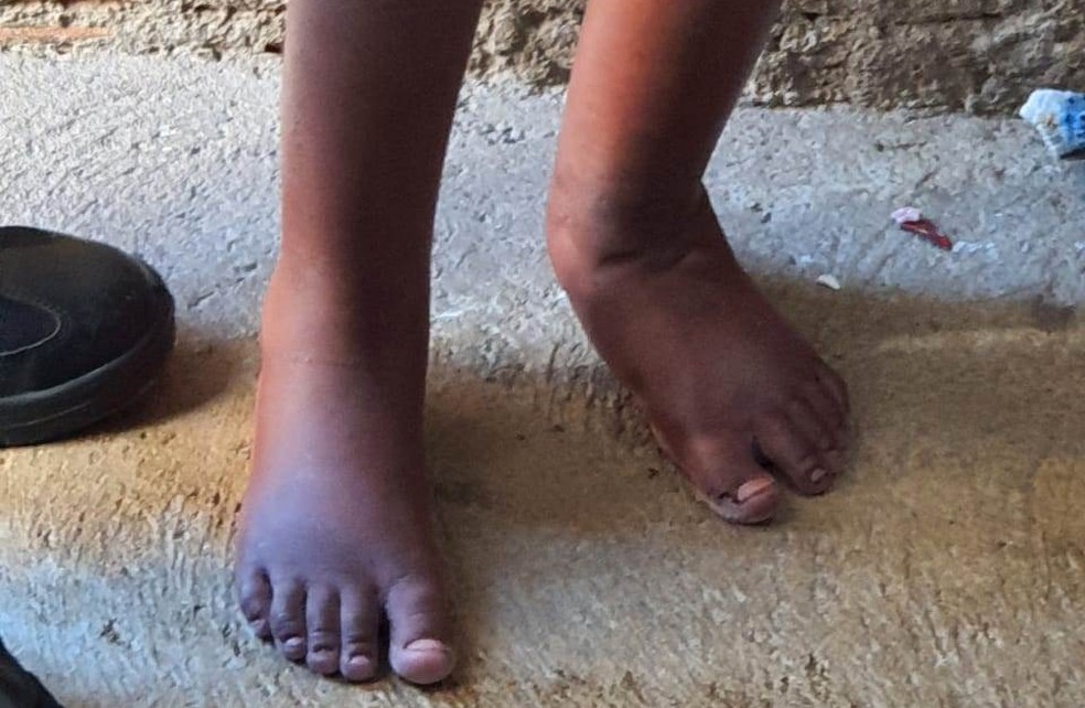Criança foi resgatada após sofrer tortura em Campinas — Foto: Polícia Militar