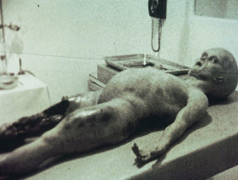 Uma cena do vídeo lendário mostrando a autópsia do alienígena (Foto: Reprodução)