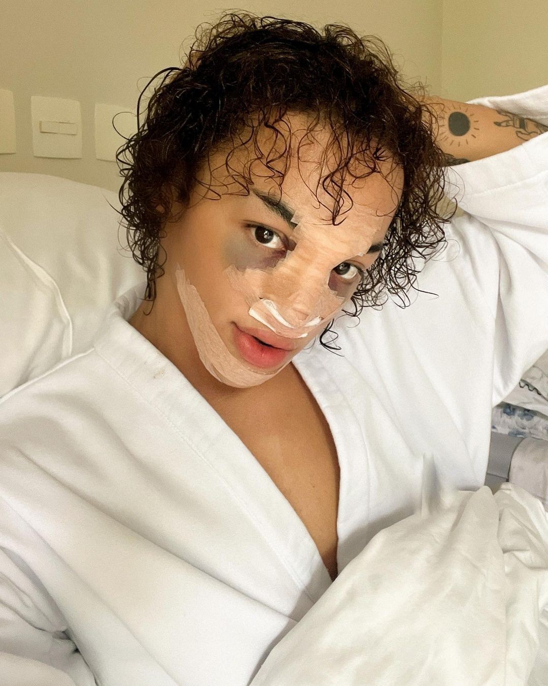 Pabllo Vittar mostra nariz com curativo e rosto inchado após rinoplastia