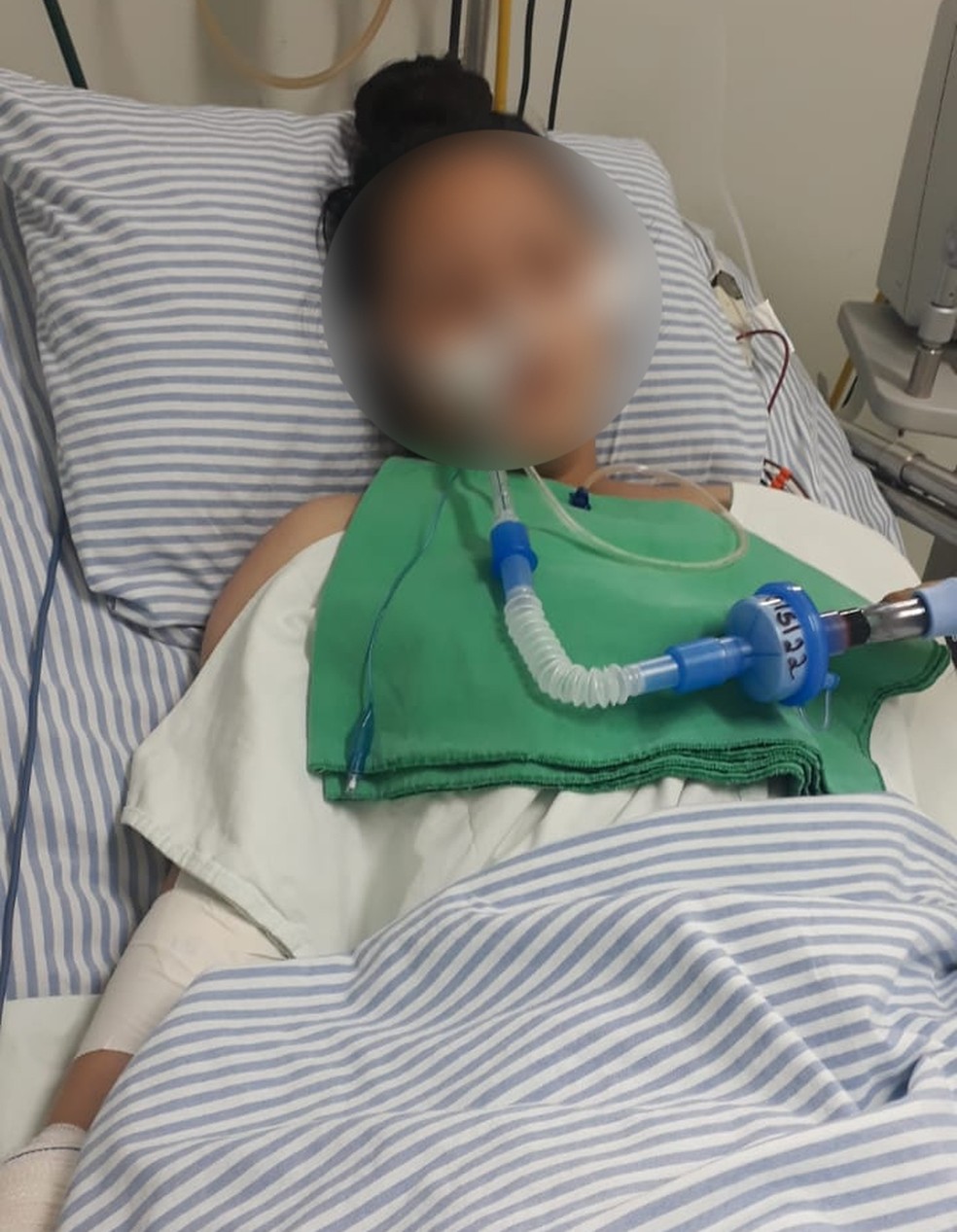 Adolescente ficou cinco dias inconsciente internada na UTI — Foto: Arquivo Pessoal