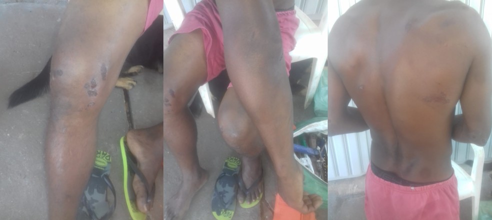 José teve ferimentos nos braços e joelhos após agressão da PM em Arealva — Foto: Arquivo pessoal