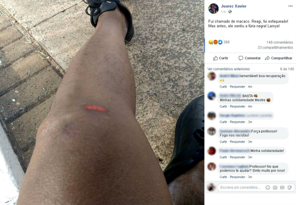 Em sua página numa rede social, professor Juarez Xavier mostra um dos ferimentos que sofreu durante a confusão e relata a ofensa racial — Foto: Facebook/Reprodução
