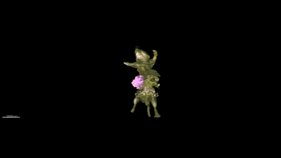 Parte em verde é o tecido saudável do camundongo; em rosa, as células cancerígenas (Foto: Cortesia de Hiroki R. Ueda (UTokio)/Kohei Miyazono (UTokio))