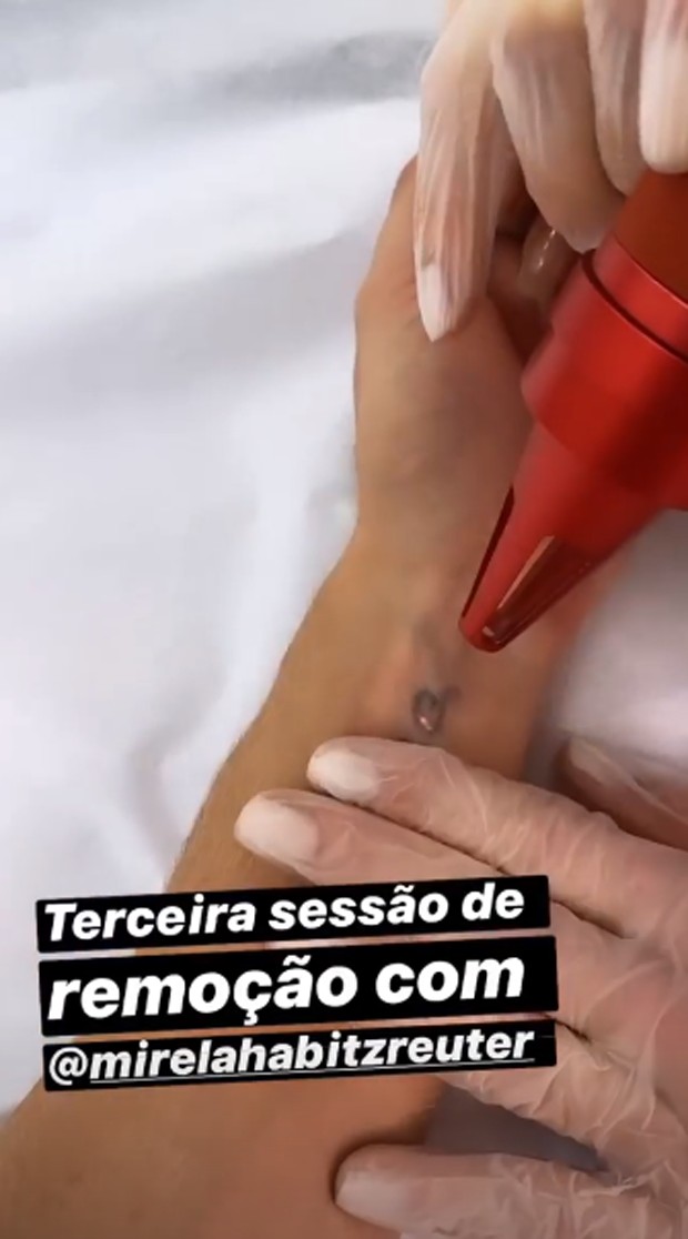 Juju Salimeni remove tatuagem com nome de Felipe Franco (Foto: Reprodução/Instagram)