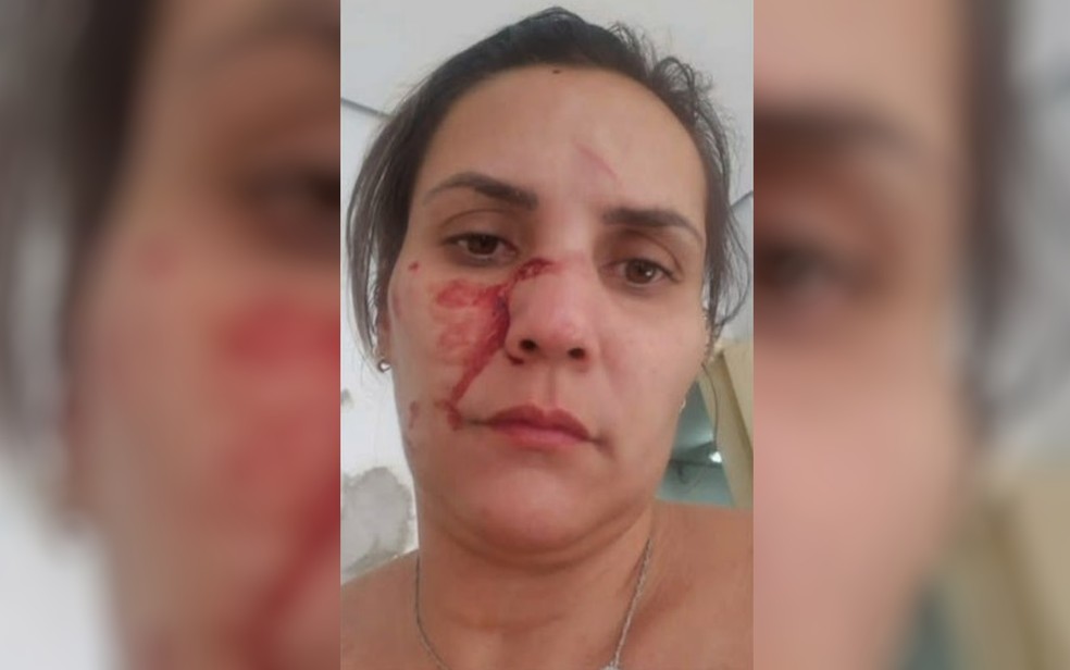 Kellen depois de uma das agressões  — Foto: TV Anhanguera/Reprodução