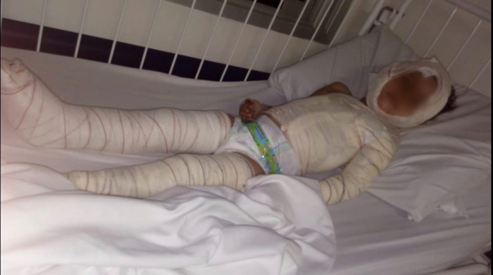 A menina Emanuele, também de quatro anos, ferida no atropelamento de janeiro de 2020, na Zona Sul de São Paulo. — Foto: Acervo pessoal