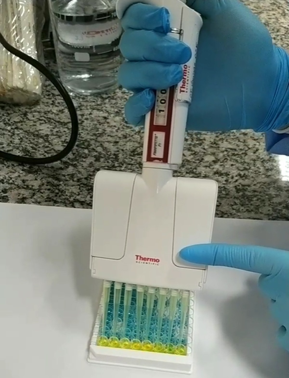 Pesquisadores da UFMG criam teste de urina para detecção de anticorpos