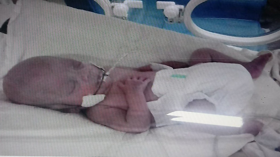 Lázaro pesava 700 gramas quando nasceu, segundo Rosana  — Foto: Rosana Mamedes Bernardo/Arquivo pessoal