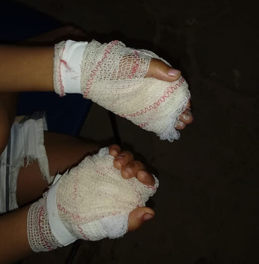 Mãe confessou que queimou as mãos do filho por ele ter roubado uma quantia em dinheiro dela — Foto: Divulgação/Polícia Civil