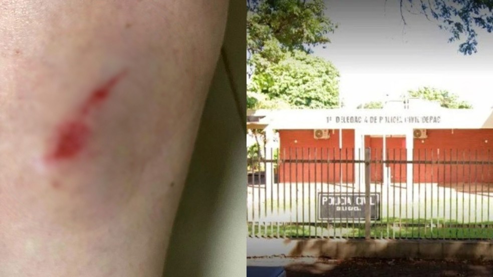 Coordenadora ficou com marcas nas pernas e o caso registrado na Depac de Dourados. — Foto: Reprodução/RedesSociais