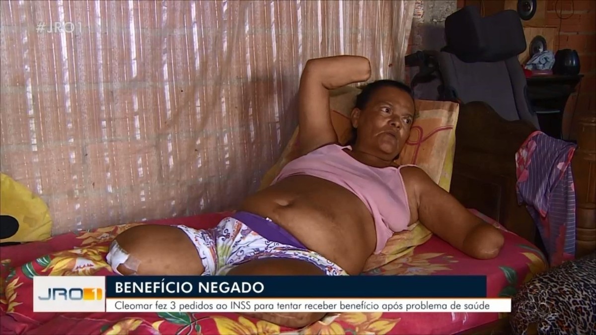 Mulher sem mãos e pernas tem pedido de benefício negado pelo INSS por não poder assinar papel, em RO