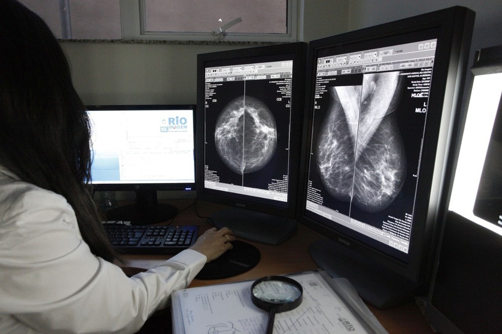 Imagem de mamografia, exame essencial para prevenção de câncer de mama — Foto: Mauricio Bazilio/Divulgação