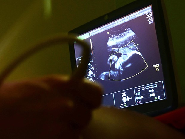 Exame de ultrassonografia realizado no Caism da Unicamp (Foto: Antonio Scarpinetti/Unicamp)