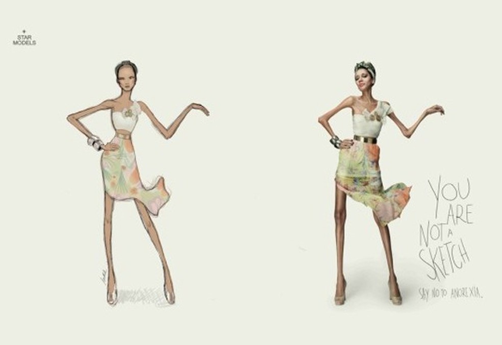 Campanha Contra Anorexia Compara Croquis A Modelos Reais Moda Glamour
