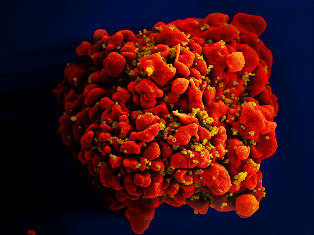 Célula infectada por partículas do vírus HIV, anexas à superfície  (Foto: National Institute of Allergy and Infectious Diseases (NIAID))