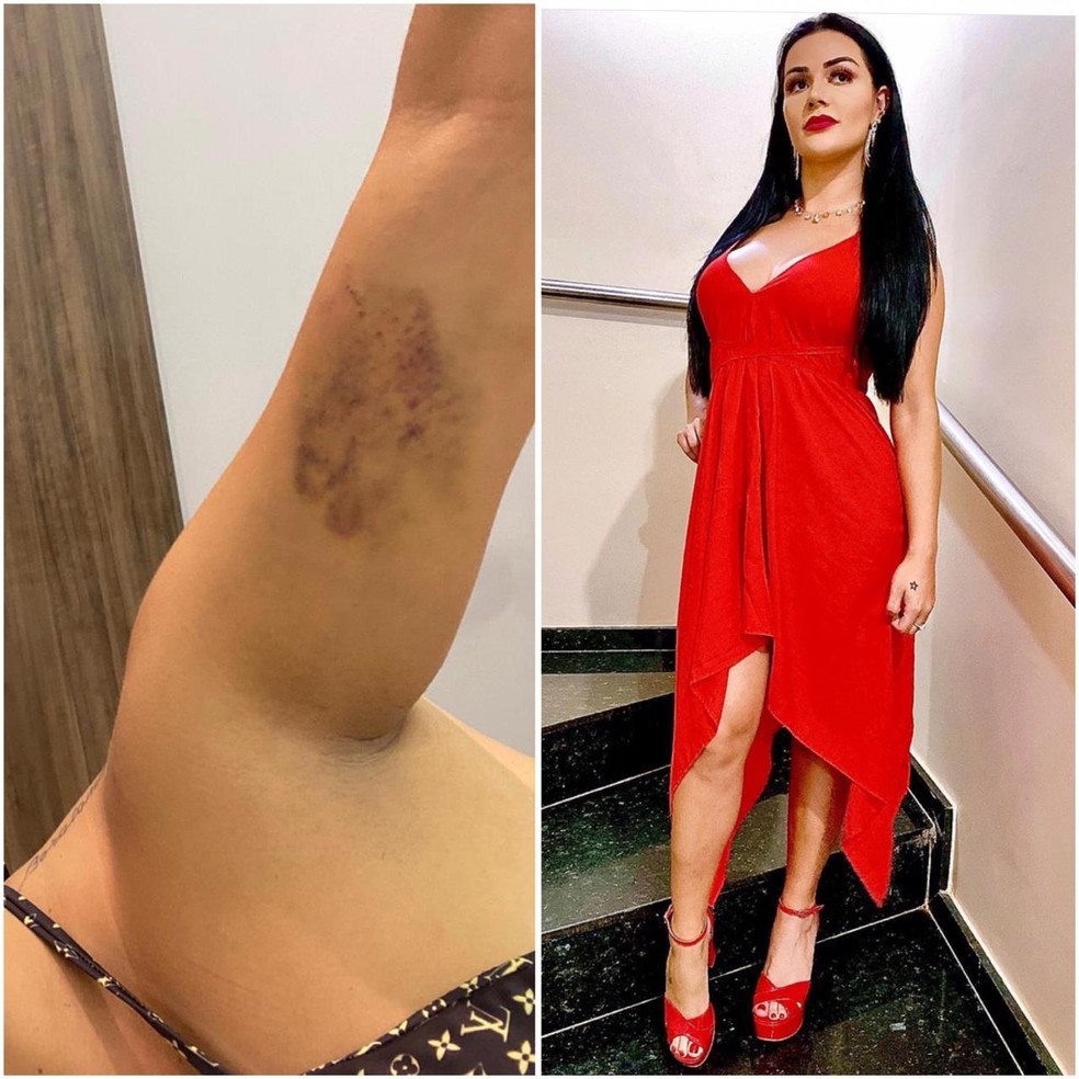 Influencer afirmou que foi agredida várias vezes pelo namorado — Foto: Carla Marina Reis/Arquivo pessoal / Instagram/Reprodução
