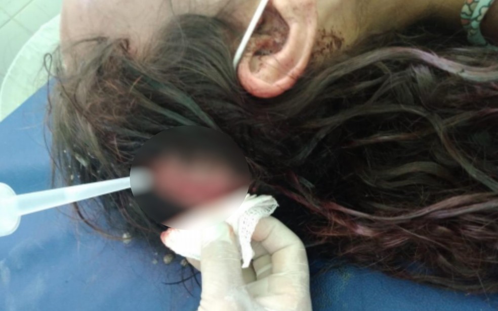 Mulher teve corte na cabeça e denuncia que foi espancada pelo marido, em Posse, Goiás — Foto: Rreprodução