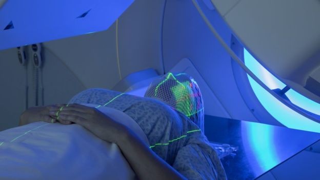 Radioterapia também traz novidades, com técnicas mais eficazes e seguras (Foto: Getty Images via BBC News)