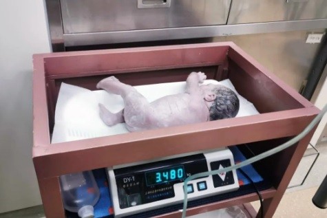 Curiosamente, bebê nasceu com o mesmo peso e tamanho do irmão mais velho (Foto: Reprodução/Weixin/Hospital de Saúde Materno-Infantil de Hubei)