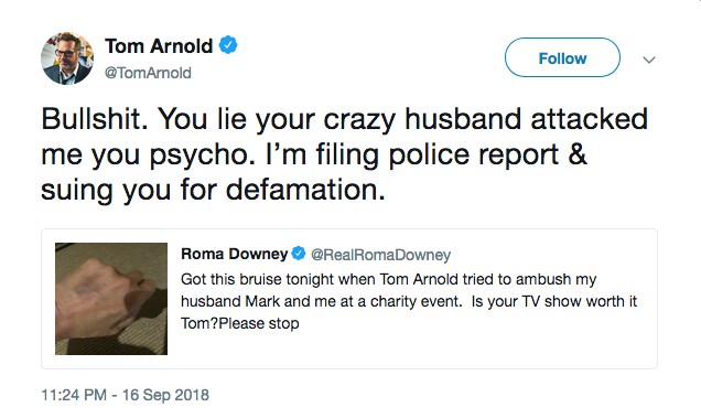 O ator Tom Arnold rebatendo as acusações da esposa do produtor que ele diz tê-lo agredido (Foto: Twitter)