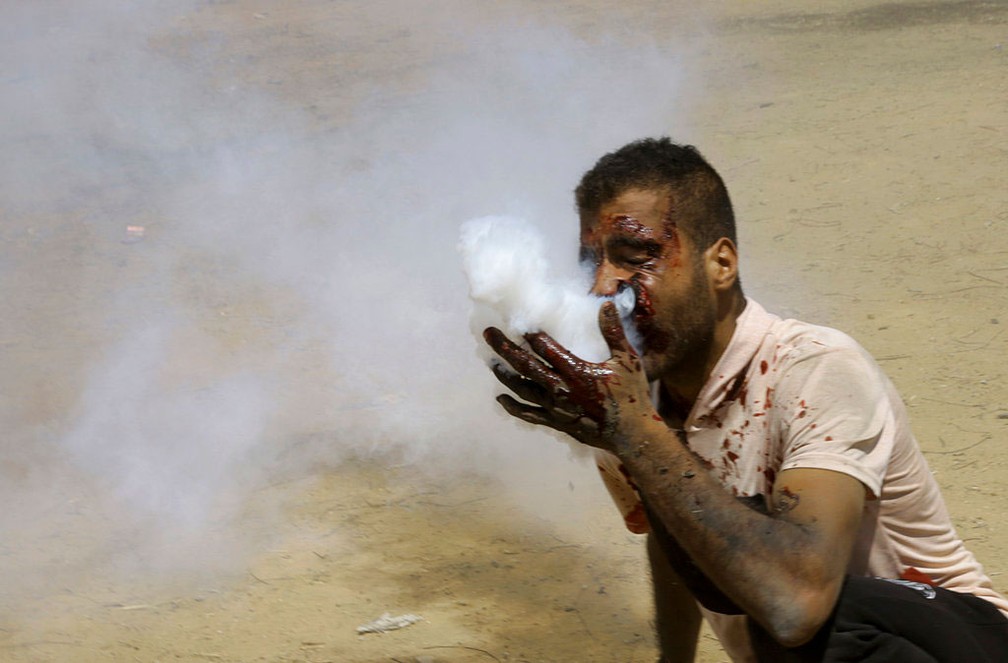 Um manifestante palestino exala gÃ¡s lacrimogÃªneo apÃ³s ser atingido na boca com uma bomba disparada pelas tropas israelenses, em Khan Younis, na Faixa de Gaza, nesta sexta-feira (8)  (Foto: Adel Hana/ AP)