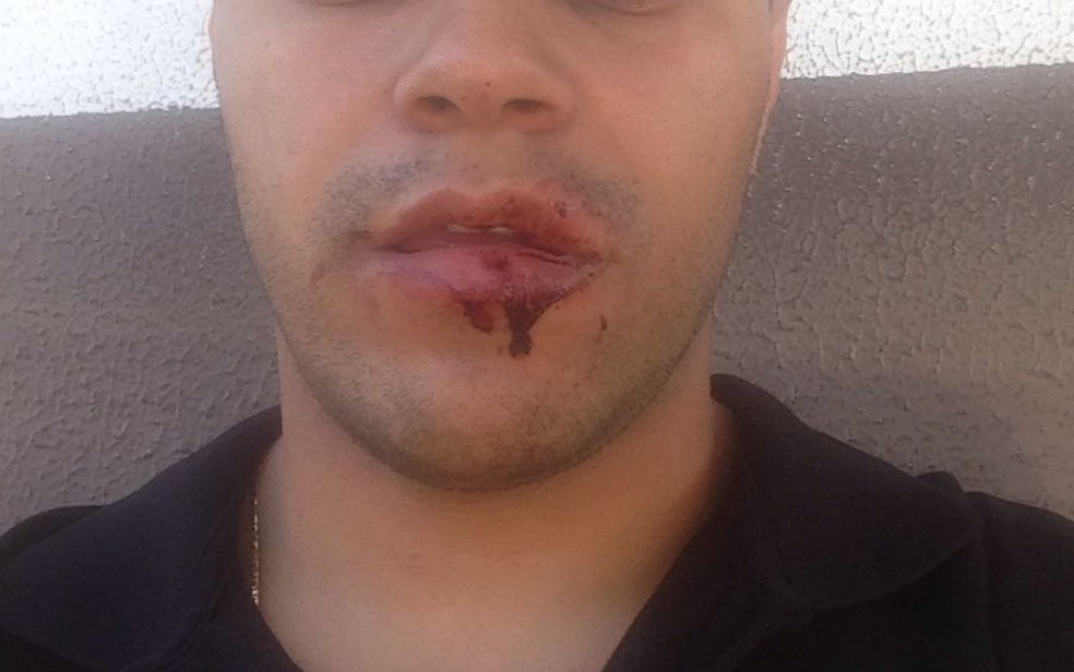Thiago Junio Martins da Silva - que prefere nÃ£o mostrar o rosto todo - diz que foi agredido pelo cantor Henrique e outras seis pessoas na festa de aniversÃ¡rio da cantora MarÃ­lia MendonÃ§a, em GoiÃ¢nia (Foto: Arquivo pessoal/ Thiago Junio Martins da Silva.)