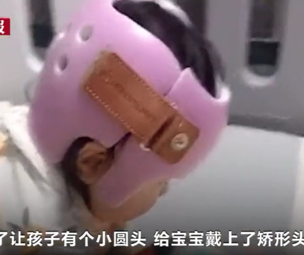 Pais chineses usam capacete ortopédico para arredondar cabeça de bebês (Foto: Reprodução/Weibo)