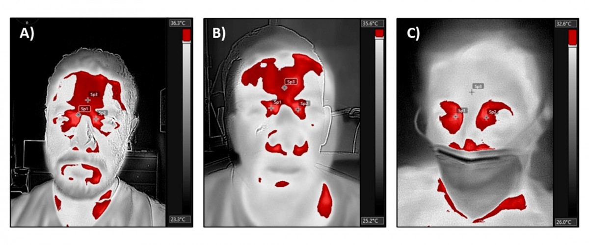 Imagem infravermelha pode diagnosticar Covid-19, segundo estudo (Foto: Universidade McGill/Divulgação)
