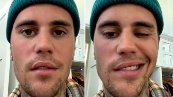 Justin Bieber mostra 'primeiros sinais' de recuperação da síndrome de Ramsay Hunt, diz médico